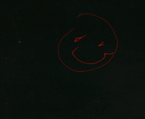 Laser-Faced Smile